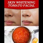 Skin Whitening Tomato Facial: Home Remedies for Every Skin Type