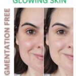 PIGMENTATION FREE GLOWING SKIN