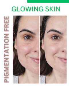 PIGMENTATION FREE GLOWING SKIN