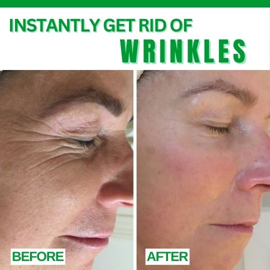 Instantly Get Rid of Wrinkles