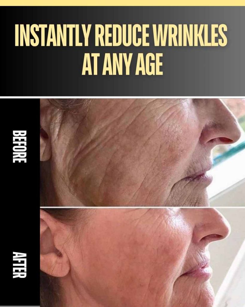 INSTANTLY REDUCE WRINKLES AT ANY AGE