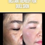 Instant Remedy for Dull Skin