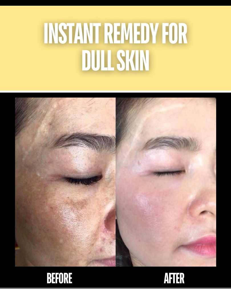 Instant Remedy for Dull Skin