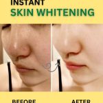 INSTANT SKIN WHITENING REMEDY