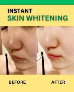 INSTANT SKIN WHITENING REMEDY