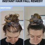 Herbal Remedies for Hair Fall: Effective Solutions for Different Scalp Types