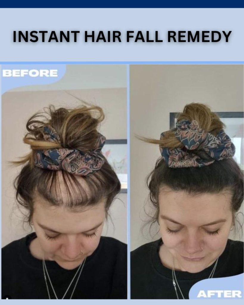 Herbal Remedies for Hair Fall: Effective Solutions for Different Scalp Types