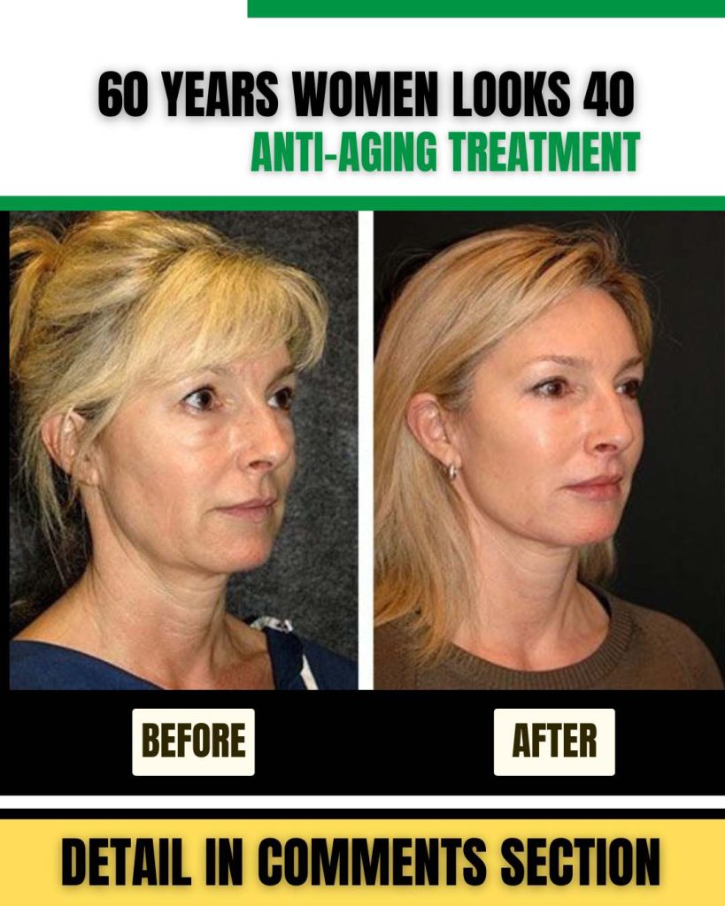 60 YEARS WOMEN LOOKS 40 ANTI-AGING HOMEMADE REMEDY