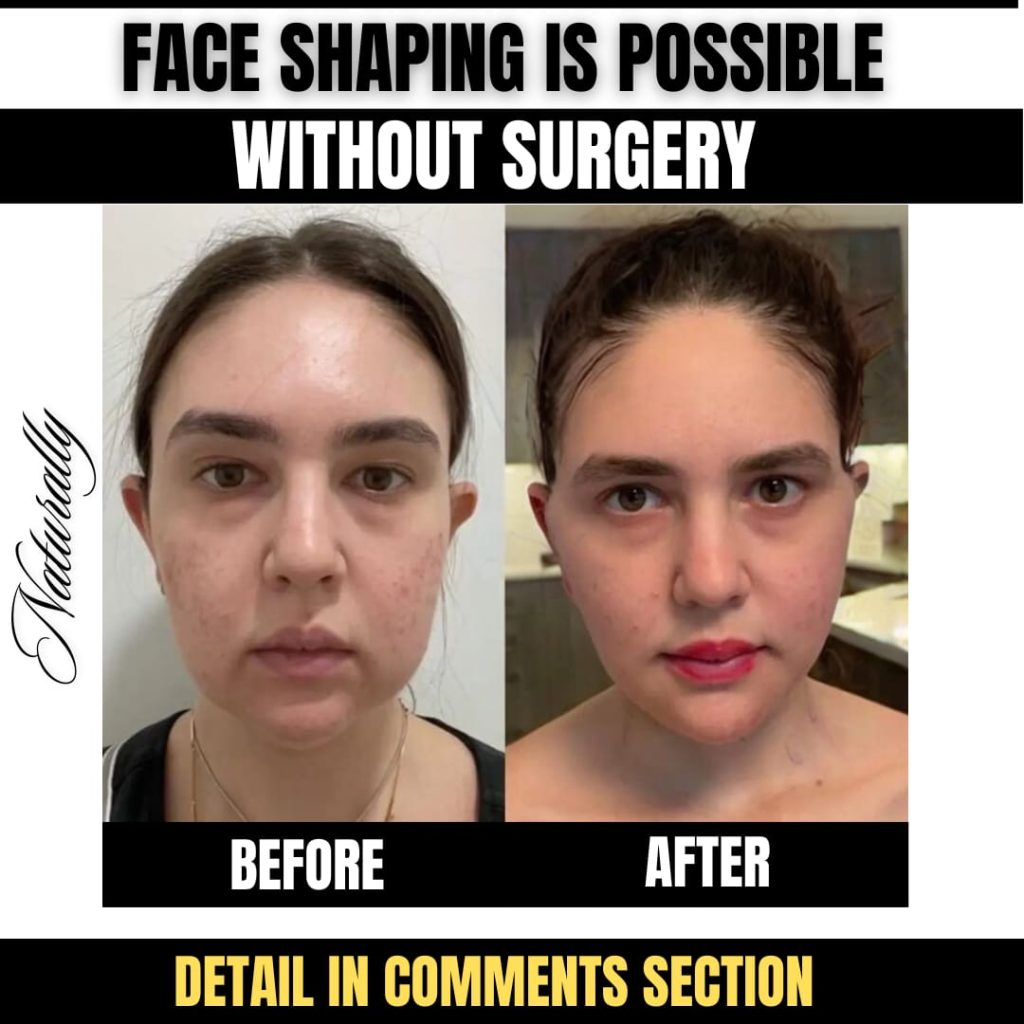 Face Shaping Without Surgery Natural Home Remedies