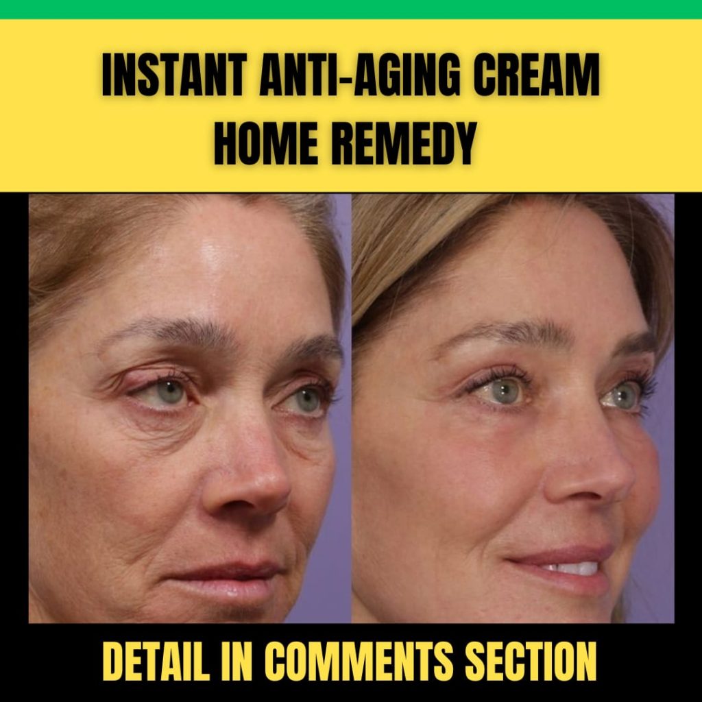 Instant Anti-Aging Cream Home Remedies