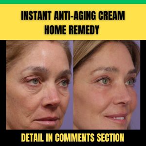 Instant Anti-Aging Cream Home Remedies