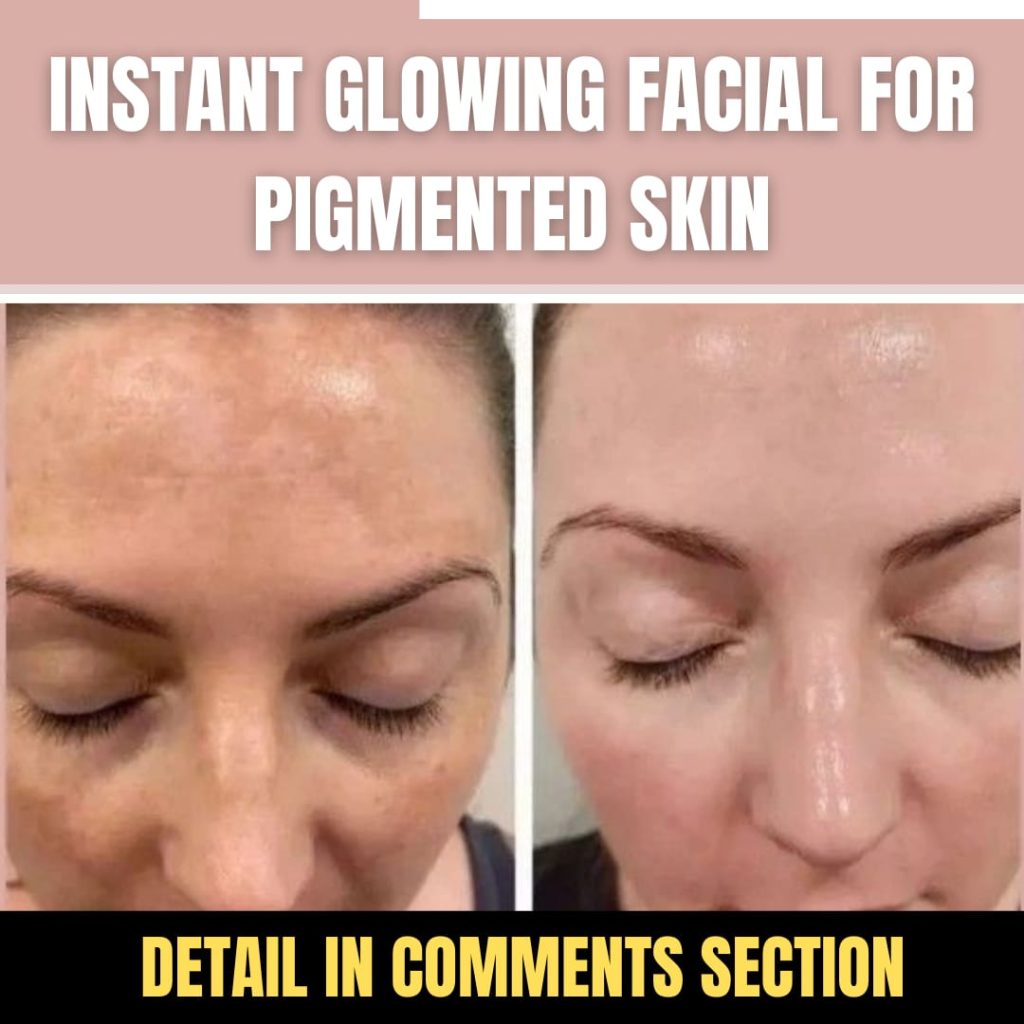 Instant Glowing Facial for Pigmented Skin Home Remedies for Every Skin Type