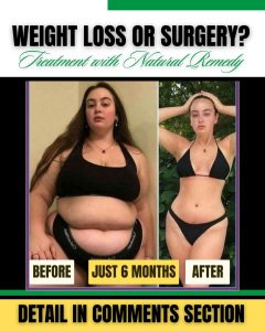 Natural Home Remedies for Weight Loss Effective and Safe Solutions
