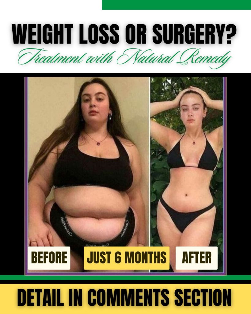 Natural Home Remedies for Weight Loss Effective and Safe Solutions