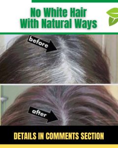 Natural Remedies to Prevent White Hair and Promote Healthy Hair Growth