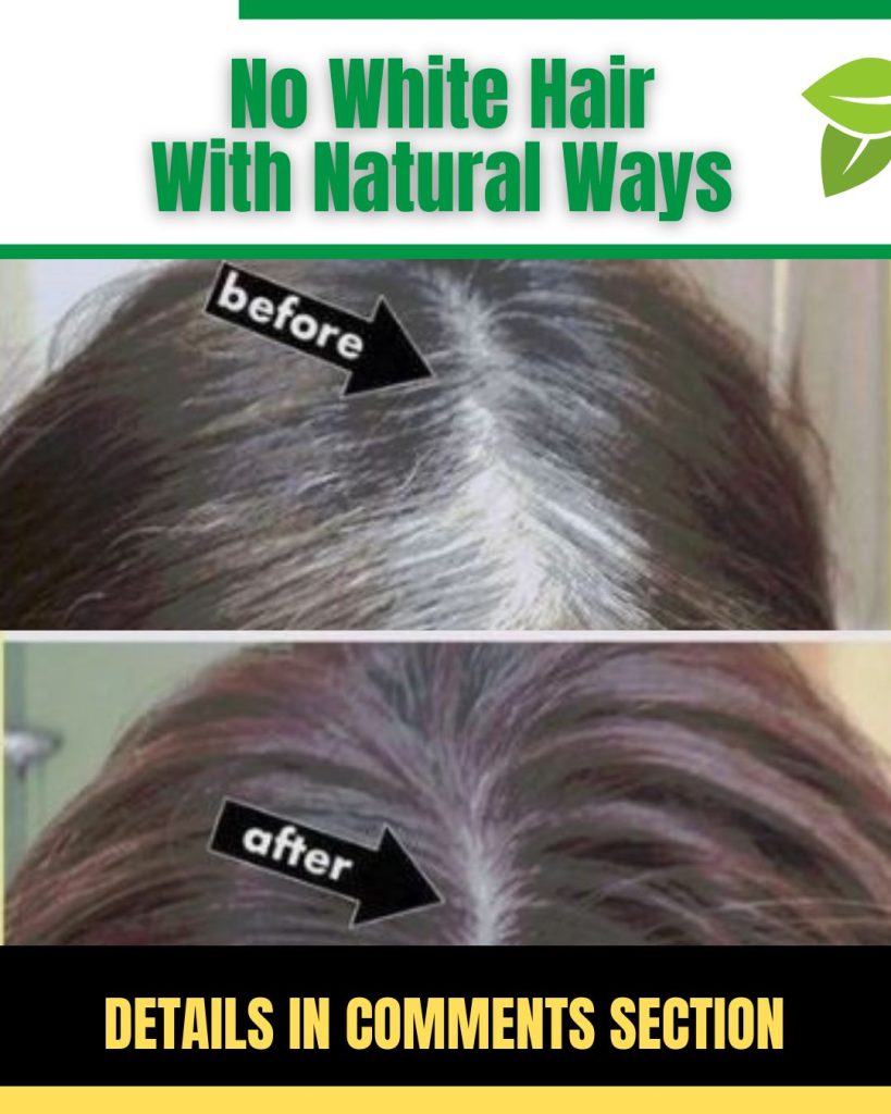 Natural Remedies to Prevent White Hair and Promote Healthy Hair Growth