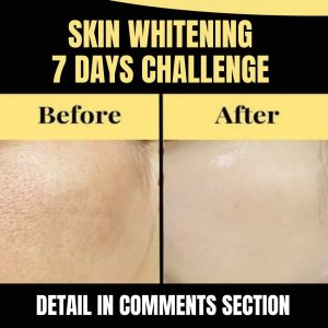 Skin Whitening 7 Days Challenge Home Remedies for All Skin Types
