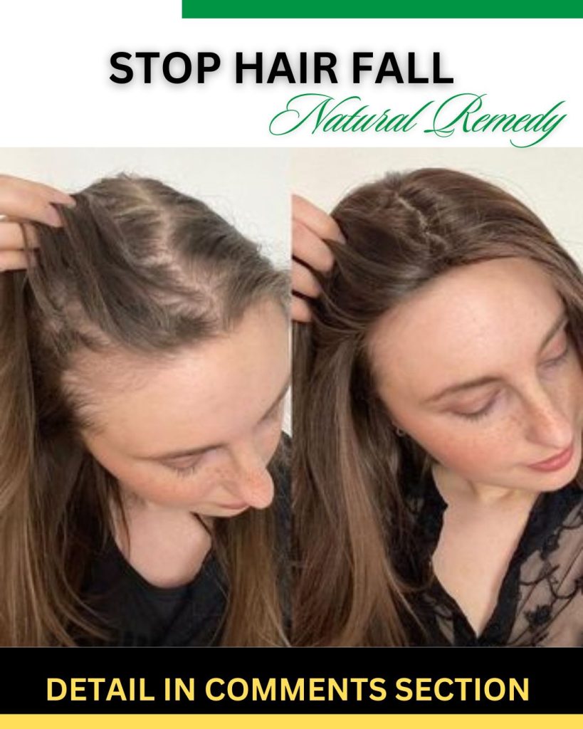Stop Hair Fall Without Chemicals Effective Natural Remedies and Nutritional Support