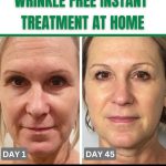 Wrinkle-Free Instant Treatment at Home Home Remedies for All Skin Types