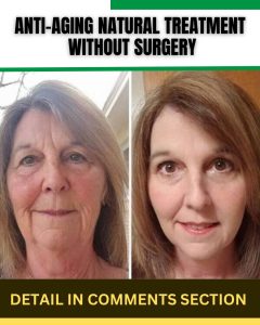 Anti-Aging Natural Treatments Without Surgery: Home Remedies for Youthful Skin