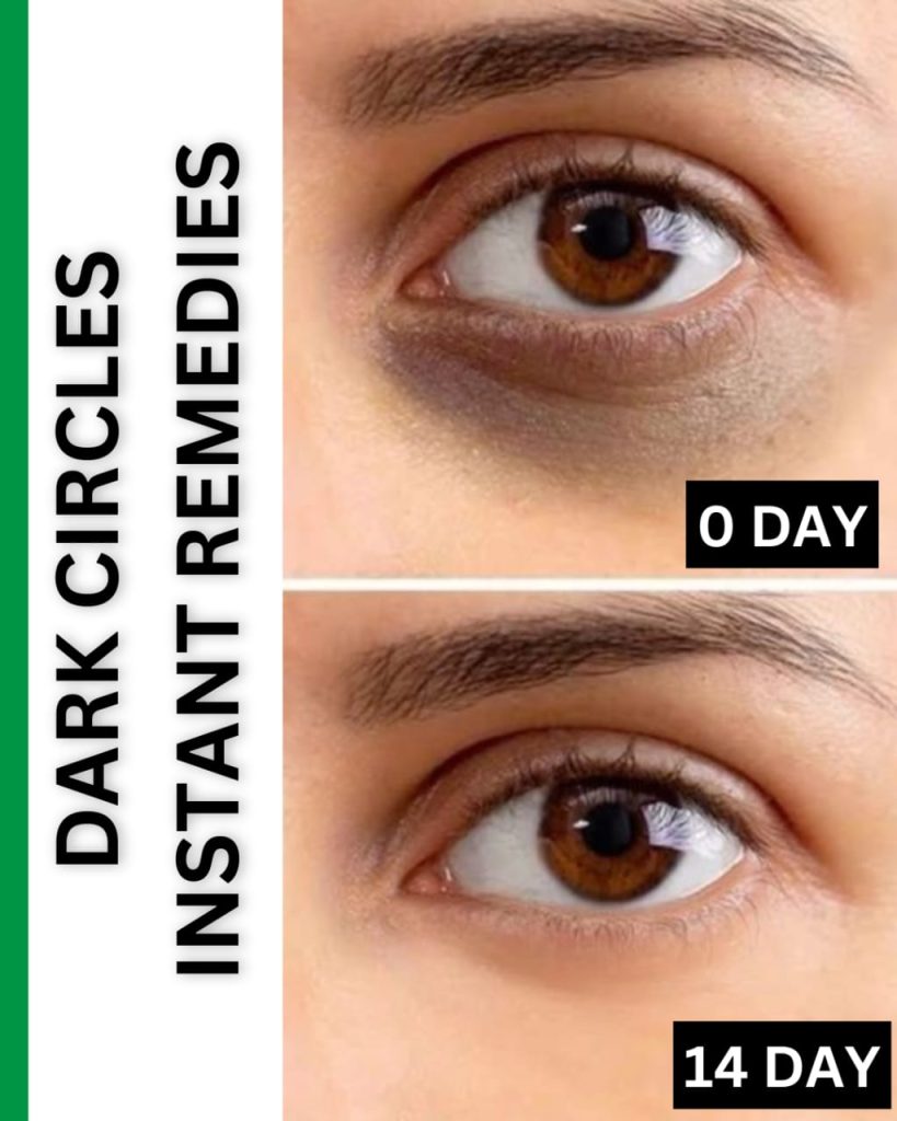 DARK CIRCLE