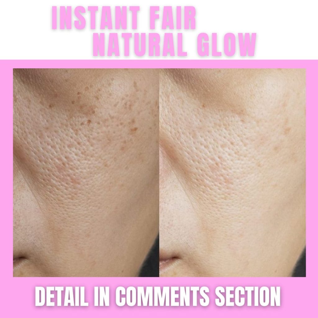 Instant Fair Skin and Natural Glow Home Remedies for Every Skin Type