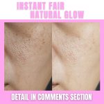 Instant Fair Skin and Natural Glow Home Remedies for Every Skin Type