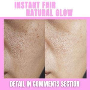 Instant Fair Skin and Natural Glow Home Remedies for Every Skin Type