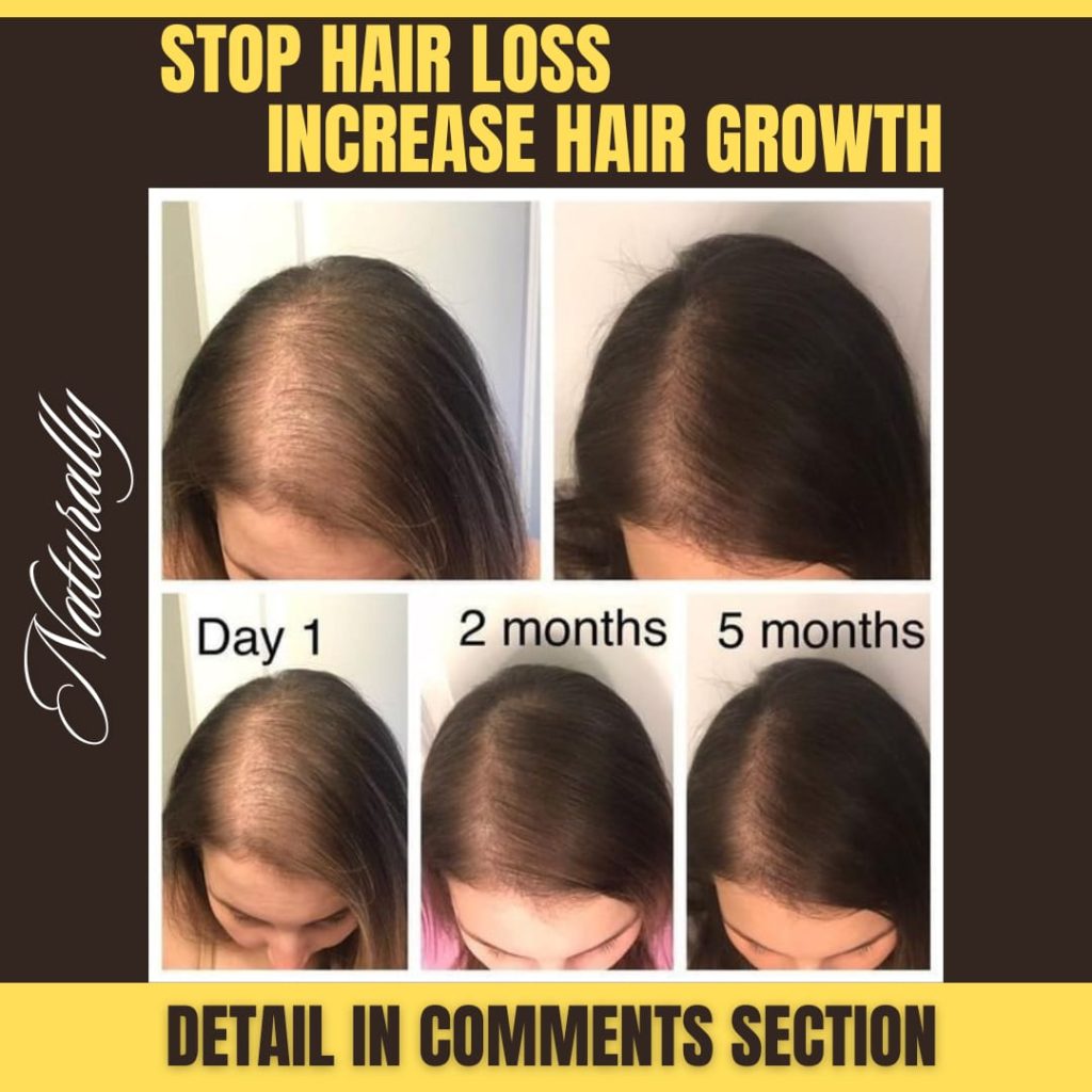 Home Remedies to Stop Hair Loss and Promote Hair Growth