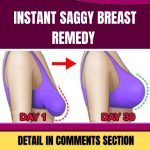 saggy breast