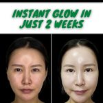 Achieve an Instant Glow in Just 2 Weeks Home Remedies for Every Skin Type