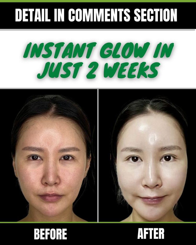 Achieve an Instant Glow in Just 2 Weeks Home Remedies for Every Skin Type