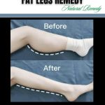 Ancient Remedies for Fat Legs A 1000-Year Tradition of Toning and Health
