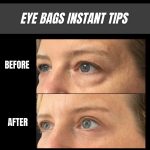 Effective Home Remedies to Instantly Reduce Eye Bags
