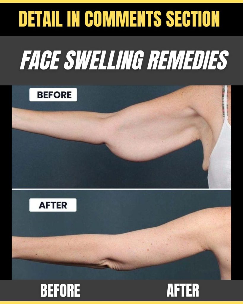 Home Remedies to Tighten Loose Skin on Arms Naturally