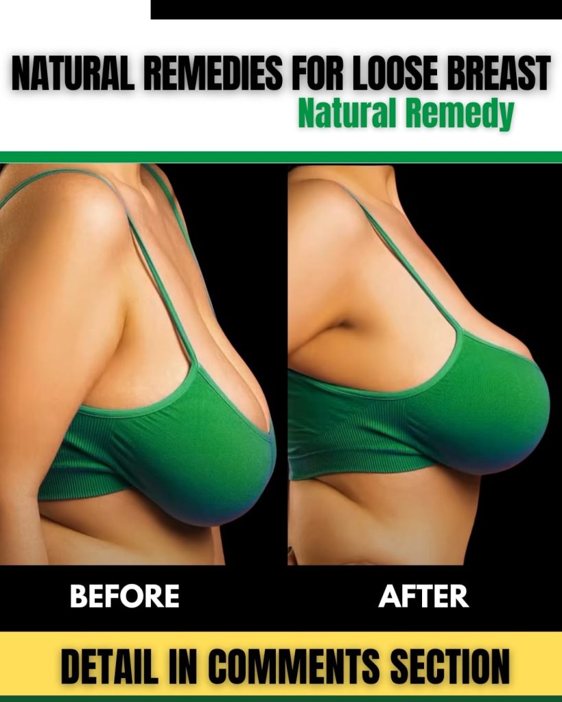 Natural Remedies for Loose Breasts