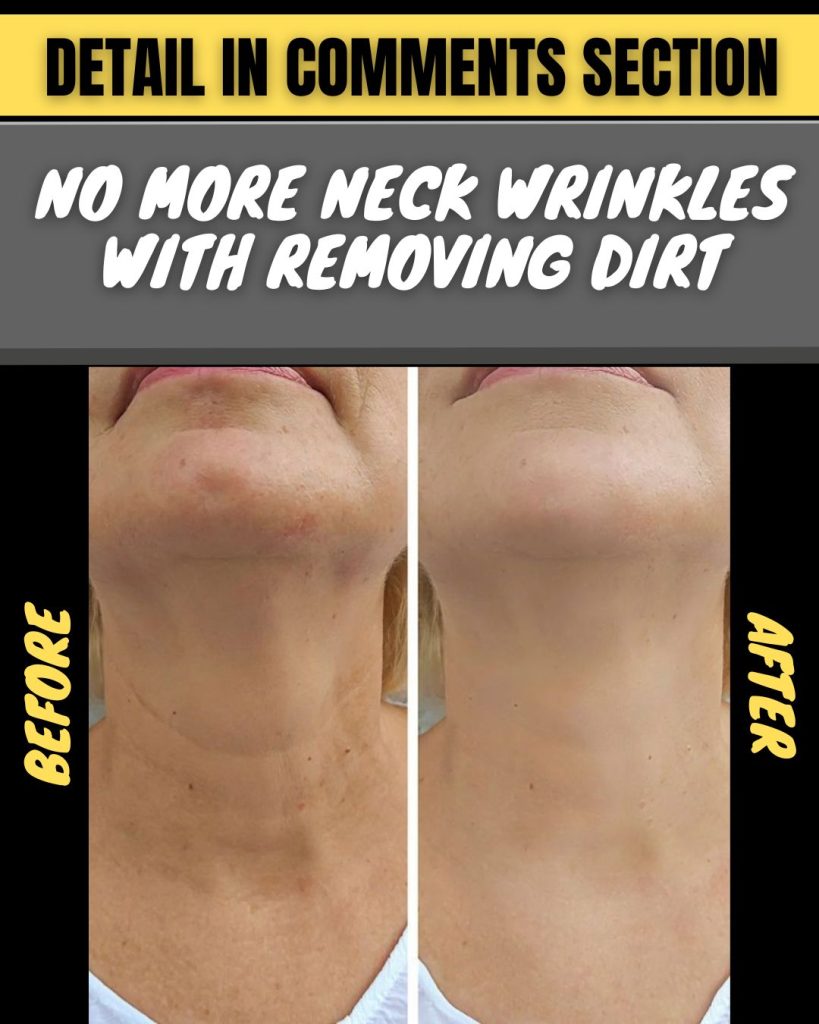 No More Wrinkles with Dirt Removal Natural Remedies for Cleaner, Youthful Skin