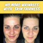 No More Wrinkles with Skin Fairness Effective Home Remedies for Every Skin Type