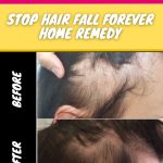 STOP HAIR FALL FOREVER HOME REMEDY