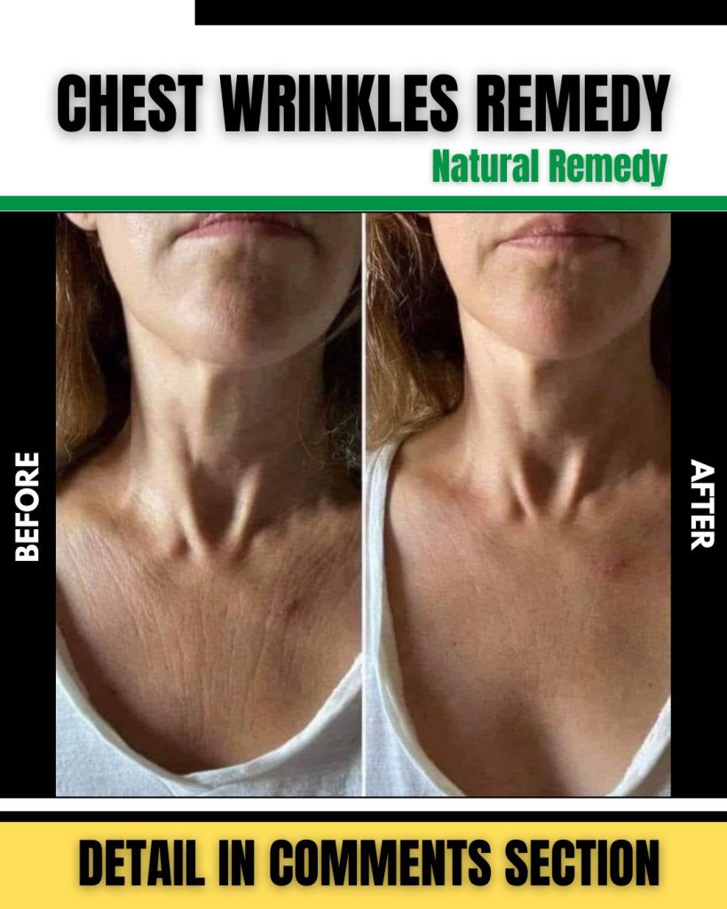 Ancient Remedies for Chest Wrinkles: Time-Honored Solutions for Youthful Skin