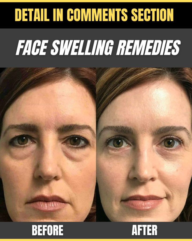face selling remedies