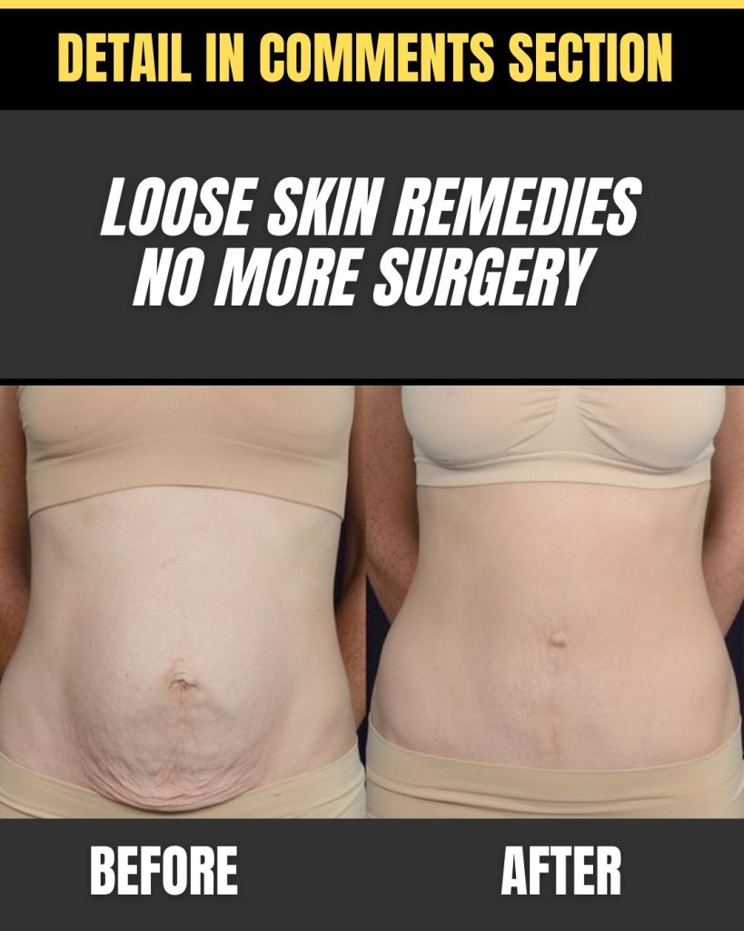 Home Remedies for Loose Tummy: Solutions by Age Group