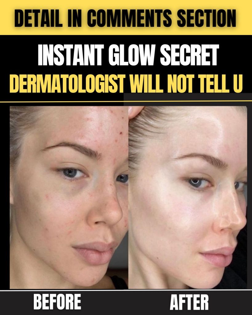 Instant Glow Secrets Will Not Tell You Home Remedies for Glowing Skin