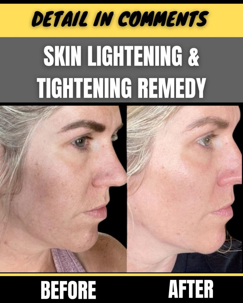 SKIN LIGHTENING