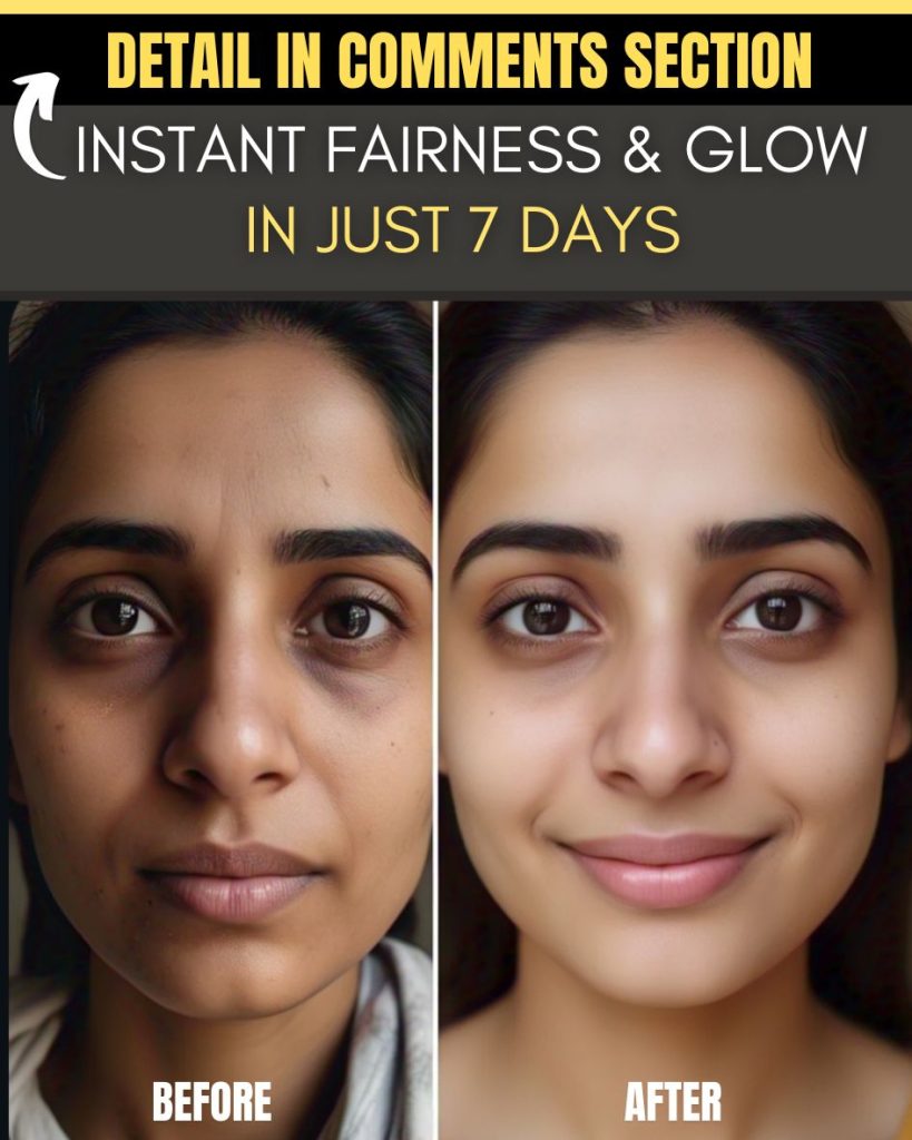 Instant Fairness and Glow in Just 7 Days