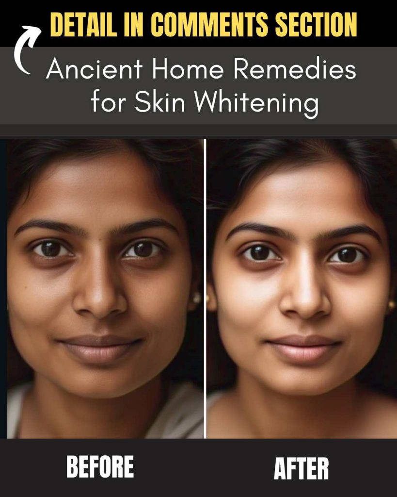 Ancient Home Remedies for Skin Whitening