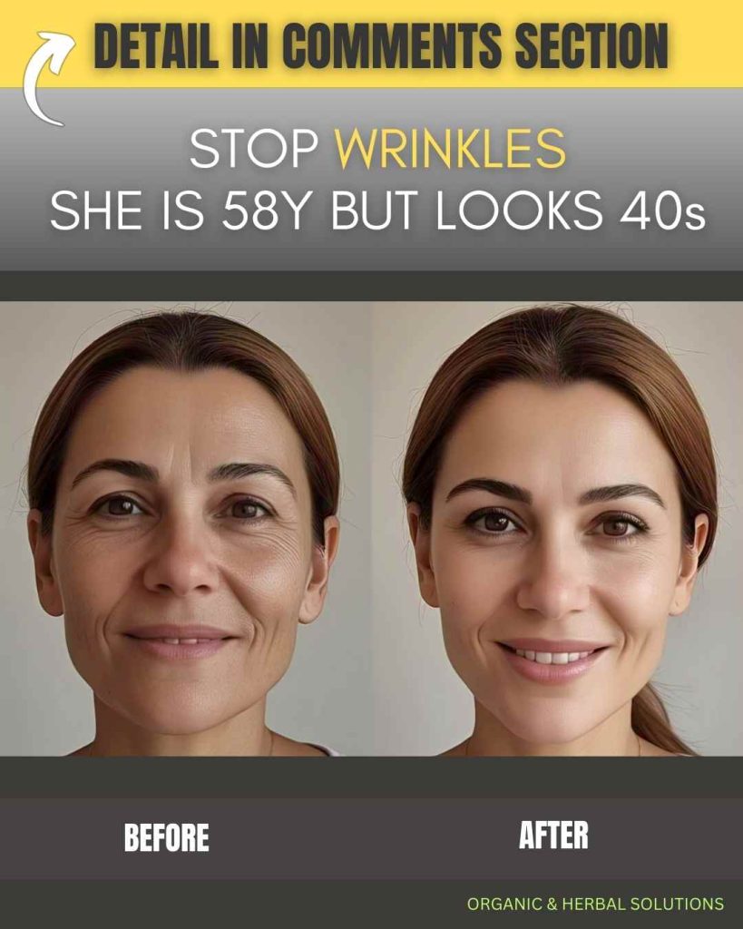Instant Home Remedies for Stopping Wrinkles – She is 58 but Looks in Her 40s