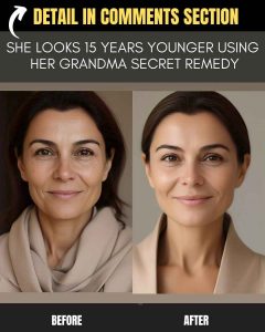 Instant Home Remedies for 'She Looks 15 Years Younger Using Her Grandma's Secret Remedy'