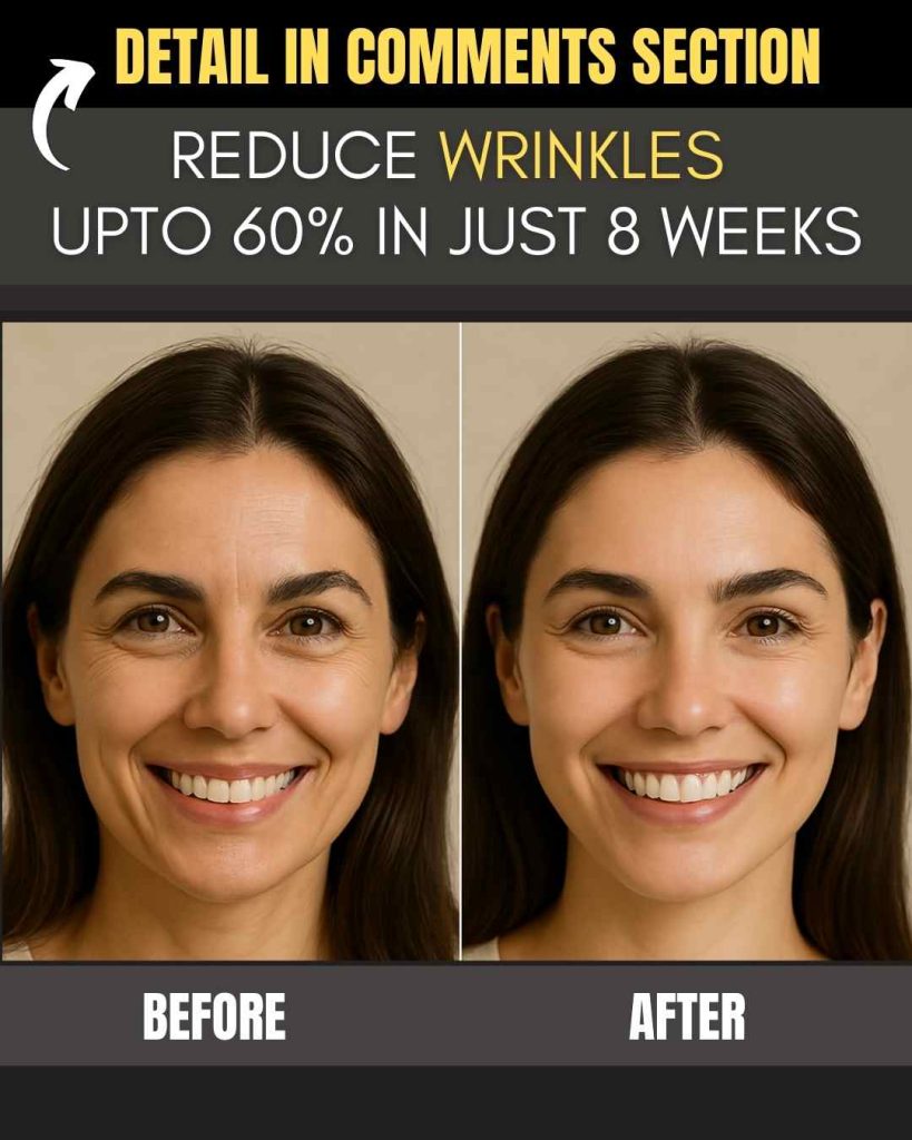 REDUCE WRINKLES UP TO 60% IN JUST 8 WEEKS