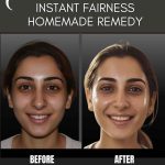 INSTANT FAIRNESS: HOMEMADE REMEDY